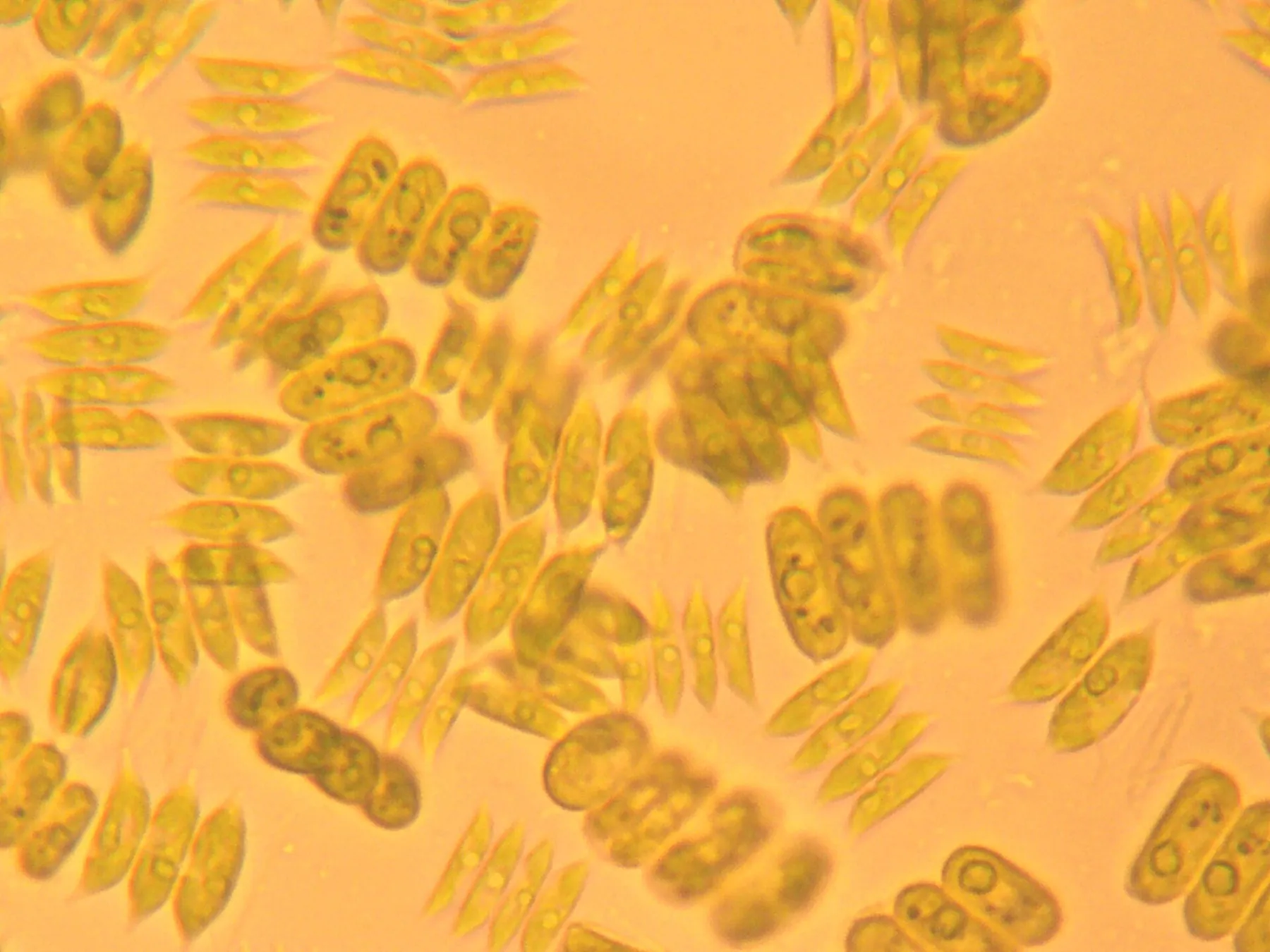 Scenedesmus spp. — Scenedesmus / Desmodesmus